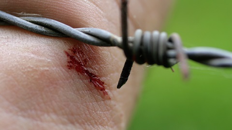 tetanus